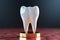 Dental healthcare 3D render of tooth root whitening treatment with a toothbrush