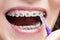 Dental Hygiene Concepts. Extreme Closeup of Female Teenager Mouth Using Bristle Brush for Cleaning Braces and Teeth