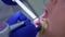 Dental hygienist makes ultrasonic cleaning pours teeth with water, closeup view.