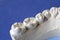 A dental implant artificial model