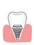 dental implant illustration cartoon icon and gingival white colors