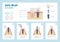 Dental implant medical procedure and structure