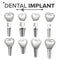 Dental Implant Set Vector. Dental Clinic Stomatology Flyer. Health Tooth Implant. Realistic Isolated Illustration