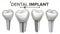 Dental Implant Set Vector. Implant Structure. Crown, Abutment, Screw. Care, Stomatology. Realistic Isolated Illustration