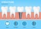 Dental implant structure with fixture, flat cartoon vector illustration