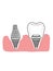 Dental implants  and gingival   illustration cartoon icon  white colors