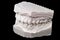 Dental impression chalk model