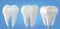 Dental model of a tooth, illustration as a concept of dental examination of teeth.