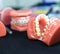 Dental or orthodontic tools, denture closeup