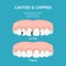 Dental poster. Dentistry and stomatology poster. Cavities and chipped