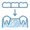 Dental Prosthesis Stomatology doodle icon hand drawn illustration