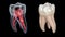 Dental root anatomy - First maxillary molar tooth. Medically accurate dental 3D animation