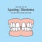 Dental spacing or diastema teeth illustration vector design on blue background. Dental care concept