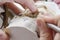 Dental technician doing partial dentures of acrylic resins.