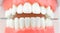 Dental Teeth Model dentures on blue background, close-up. Regular checkups are essential to oral health. Orthodontic tools, brace