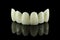 Dental Tooth Bridge