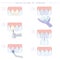 Dental treatment and care. Installation of veneers, stages of work. Instructions for dentists. Vector illustration for dentistry