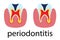 Dental treatment poster periodontitis. Human molar tooth