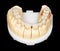 Dental zirconia bridge