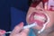 Dentist applying gel for LED whitening to woman patient`s teeth in dentistry.