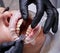 Dentist attaching orthodontic brackets to woman teeth.