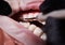 Dentist attaching white braces to patient teeth.