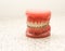 Dentist demonstration teeth model of orthodontic bracket