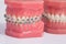 Dentist demonstration teeth model of varities of orthodontic bra