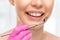 A dentist doctor treats caries on a tooth of a young beautiful woman in a dental clinic. Tooth filling