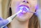 Dentist doing procedure with dental curing UV light in clinic