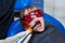 A dentist is examining a child patientâ€™s teeth with a UV light lamp