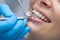 Dentist examining a patient\'s teeth in the dentist