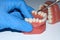 Dentist hand show dental teeth model jaw in laboratory