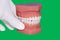 Dentist hand show model of teeth