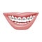 Dentist, orthodontist. Vector illustration. Braces on teeth. open mouth.