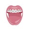 Dentist, orthodontist. Vector illustration. Braces on teeth. open mouth.