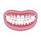 Dentist, orthodontist. Vector illustration. Braces on teeth. open mouth.