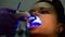Dentist puts the brackets on the teeth of the patient woman;checking with the dental mirror and than fixing with laser