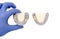dentist`s hand holds tooth crowns. ceramic-metal and ceramic dental bridges. isolated