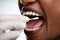 Dentist`s Hand Taking Saliva Test From Woman`s Mouth