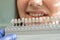 Dentist selects color palette for dental treatment smiling woman at clinic. Teeth enamel whitening concept.