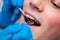 Dentist treatment a patient\'s teeth in the dentist.