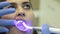 Dentist using dental curing UV lamp on teeth of patient