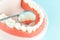 Dentistry conceptual photo. Close-up individual tooth tray Orthodontic dental theme. Dentistry conceptual photo. Prosthetic
