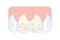 Dentistry: Damaged enamel of the front teeth. Dental problems. Vector illustration for teaching materials on dentistry