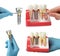 Dentists showing educational models of dental implants on white background, closeup. Collage