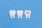 Dentition with upset paper tooth, concept of dental problems, caries, gum inflammation, mouth infections