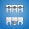 Denture concept - healthy teeth with a dental implant and braces on top of them. Vector illustration of human teeth in a 3d