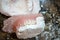 Denture Making Process of Removing From the Mold