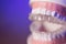 Denture with transparent orthodontics